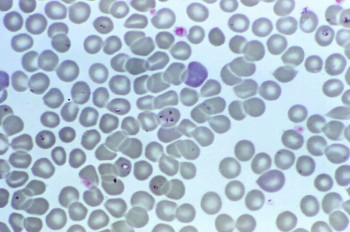 parasita plasmodium falciparum